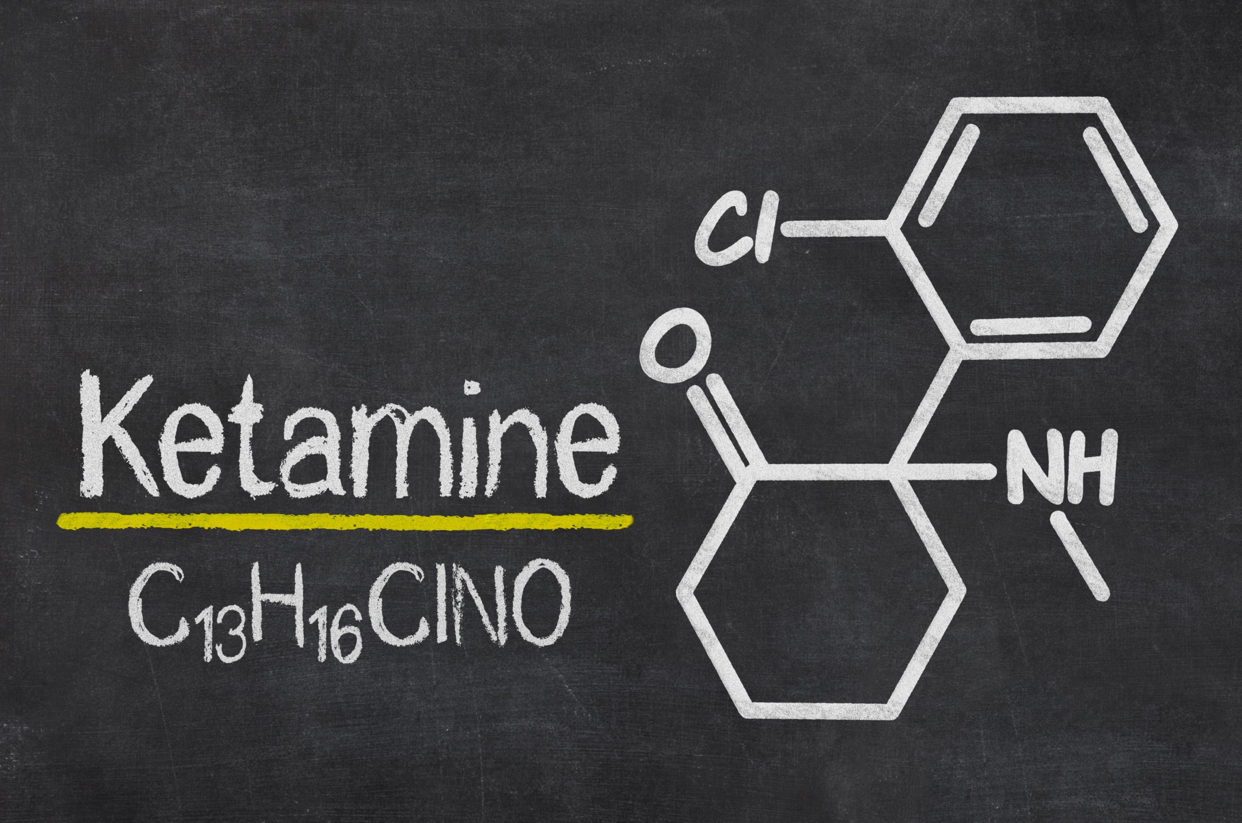 Ketamine: A Temporary Fix, Not a Cure for Depression